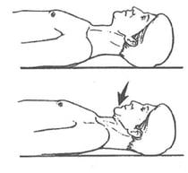 Deep neck flexor activation