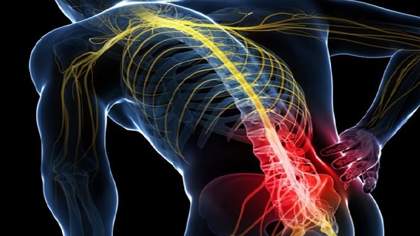 La debilidad de los glúteos causa realmente dolor lumbar?