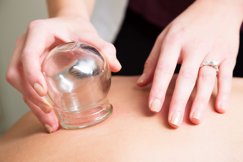 Close up of cupping treatment.