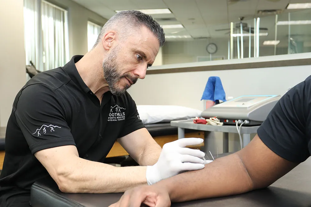 Therapist using dry needling treatment for arm pain.